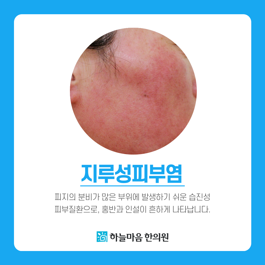 하늘마음한의원 을지로 대표 이미지