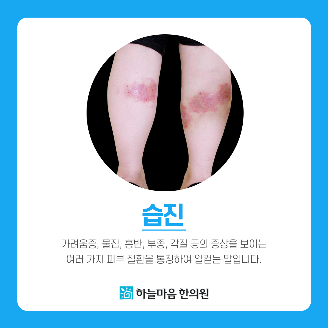 하늘마음한의원 은평 대표 이미지