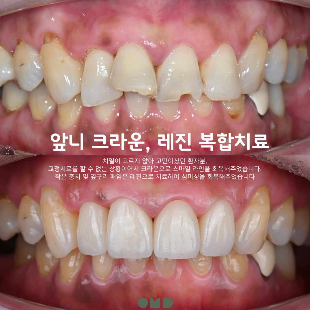 이보다치과 부천본원 대표 이미지
