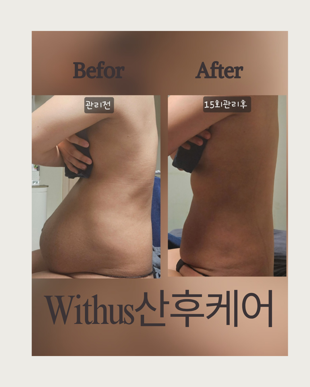 위더스산후케어 남양주구리점 photo 10