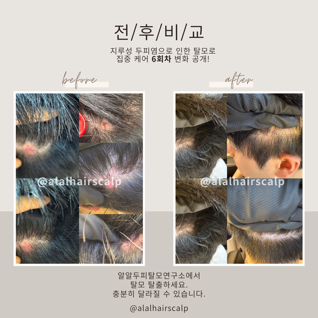 알알탈모 두피연구소 대표 이미지