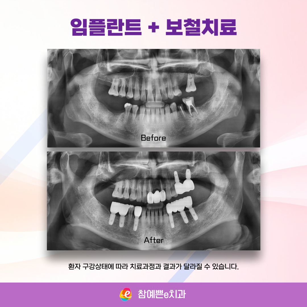 참예쁜e치과의원 대표 이미지