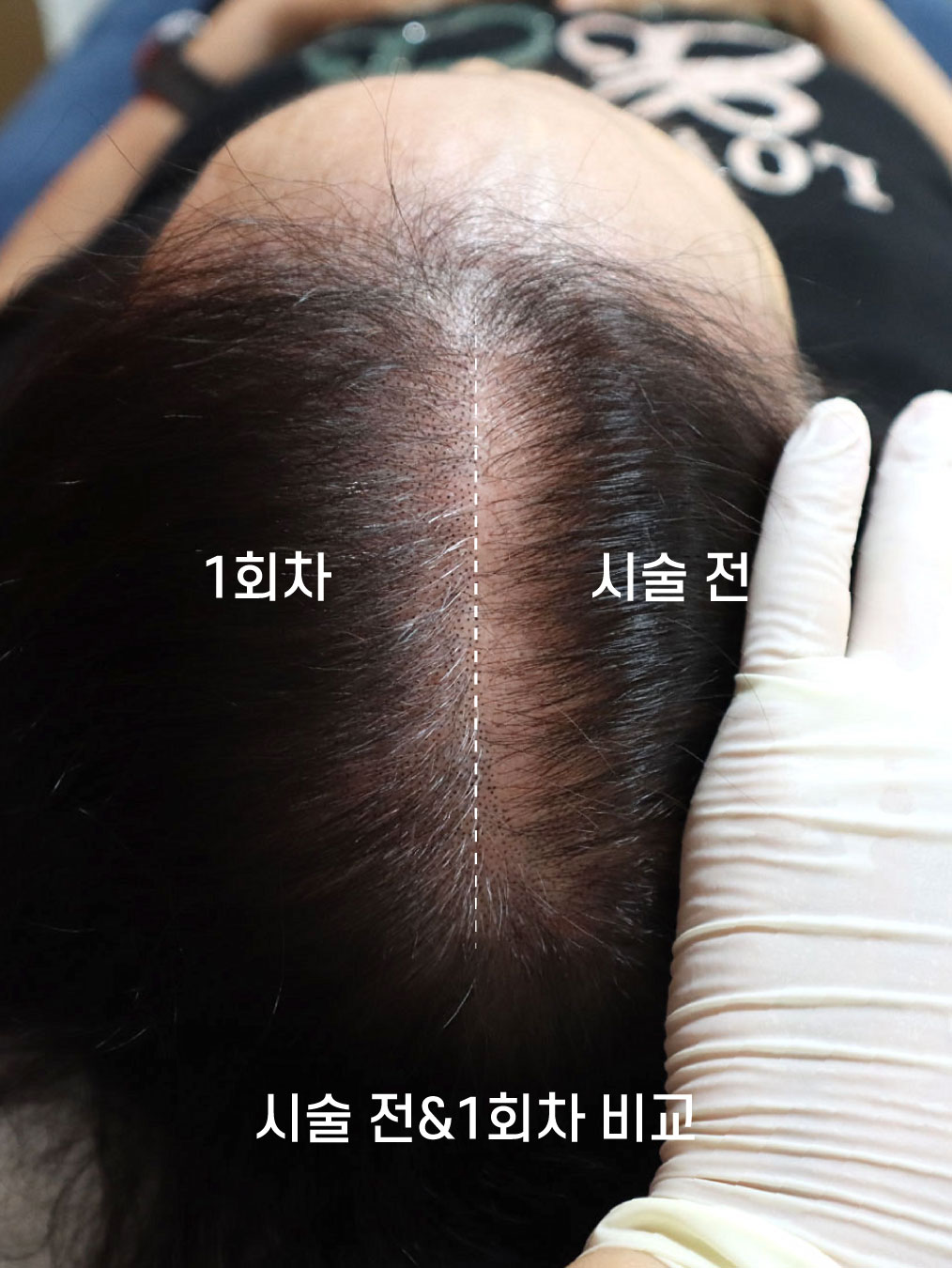 나는소년이었다SMP 대표 이미지