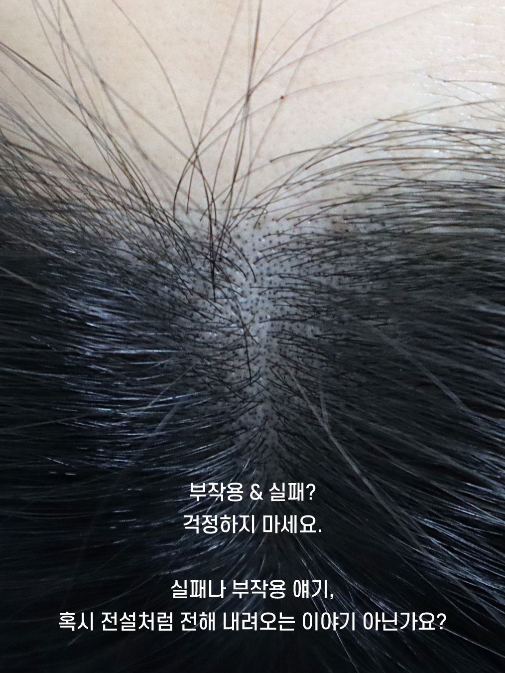 나는소년이었다SMP 대표 이미지