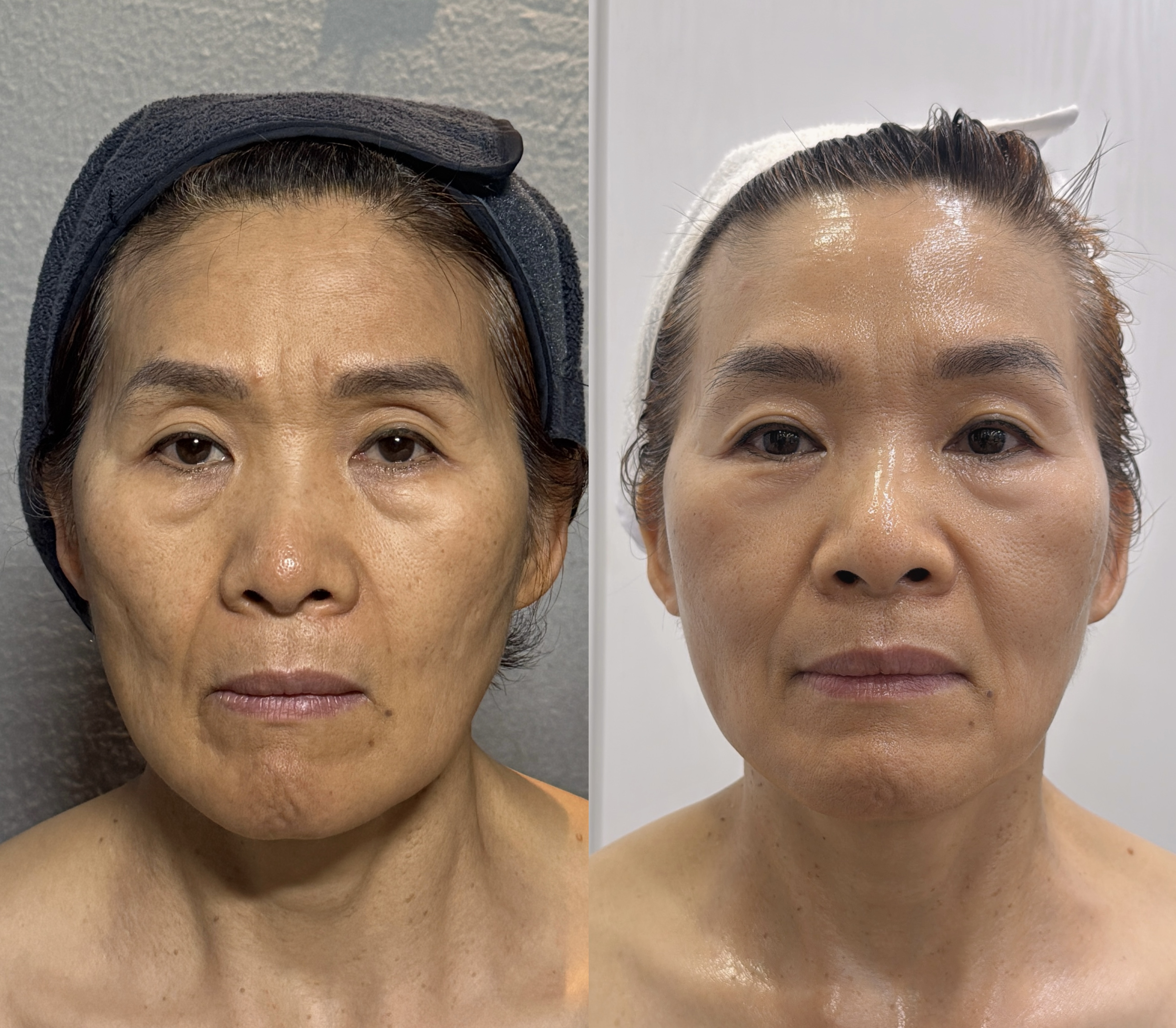 웰바디 영통점 photo 3