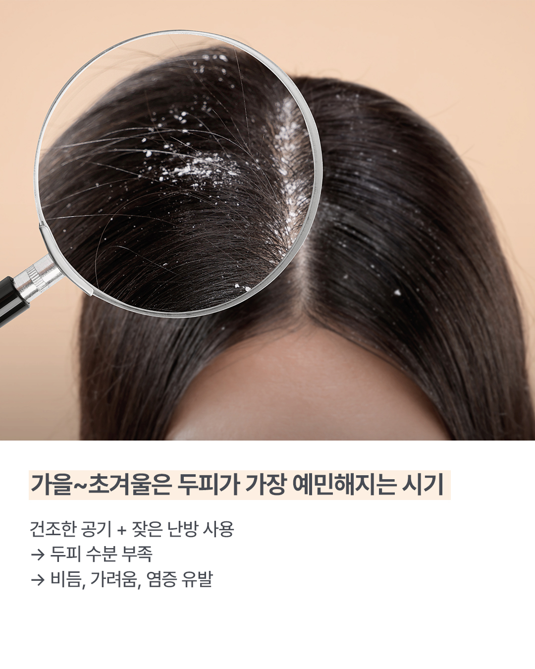 웰킨두피탈모센터 마곡점