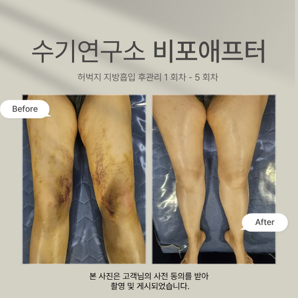 수기연구소 관리 이미지