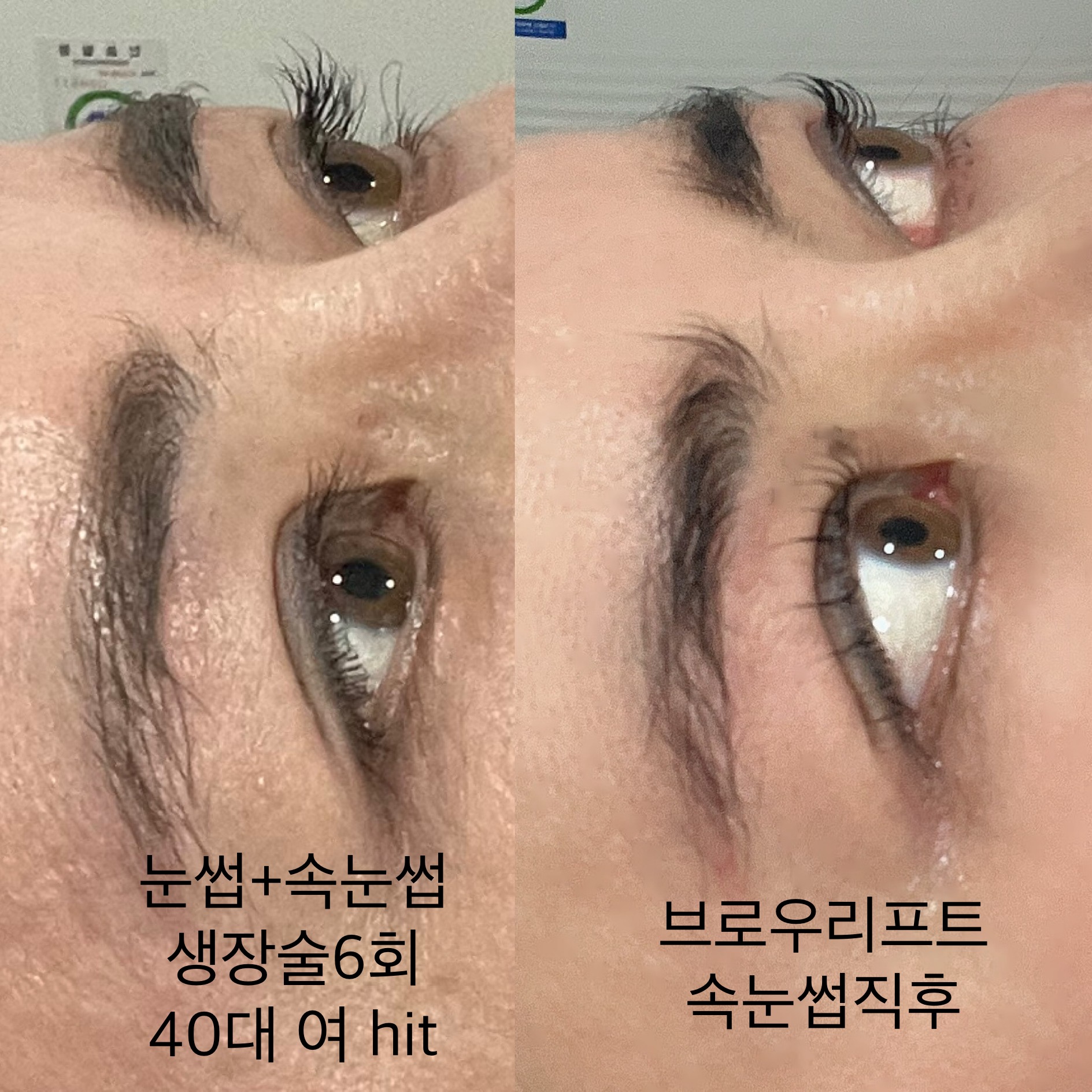 히트왁싱태닝 대표 이미지