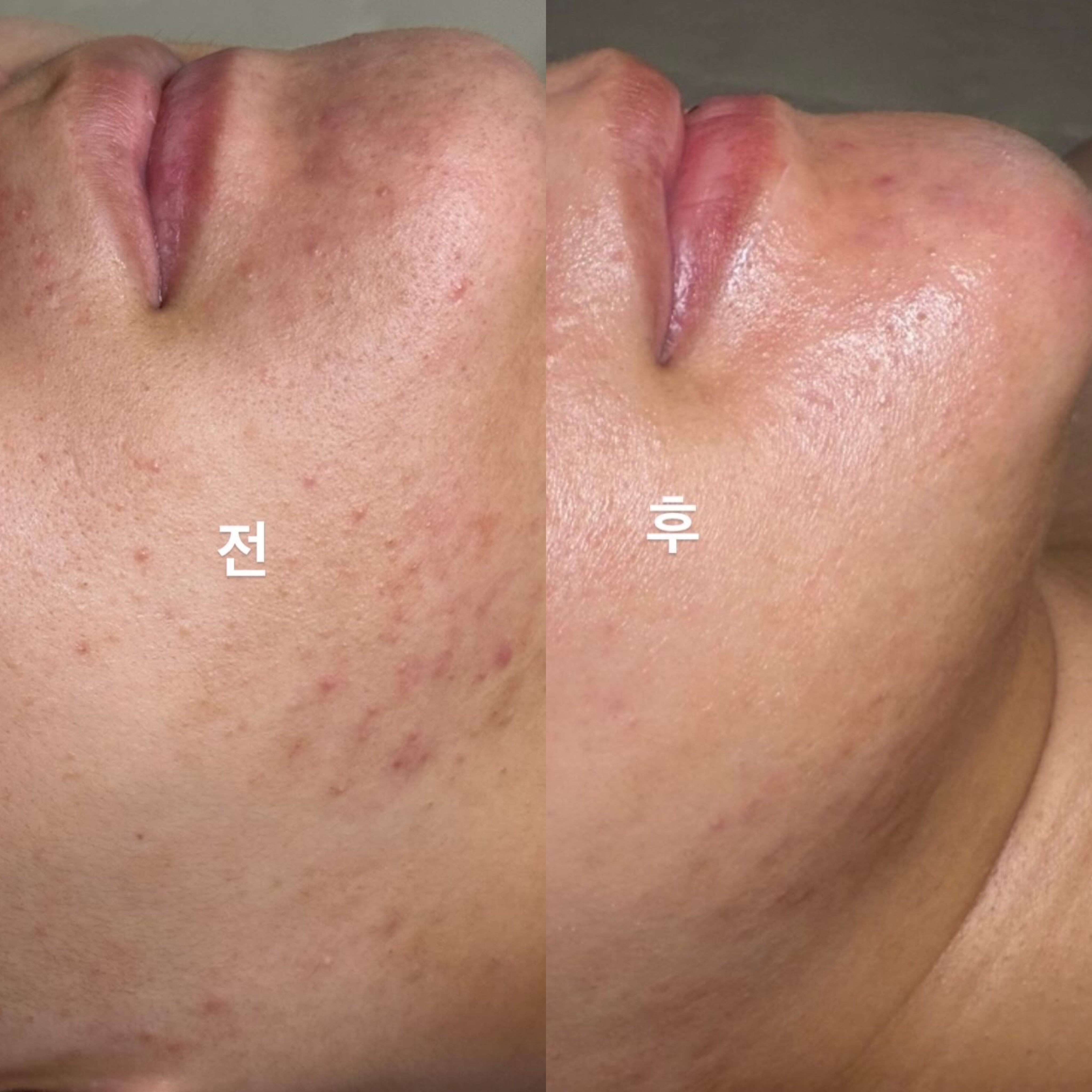 피부하라 photo 7