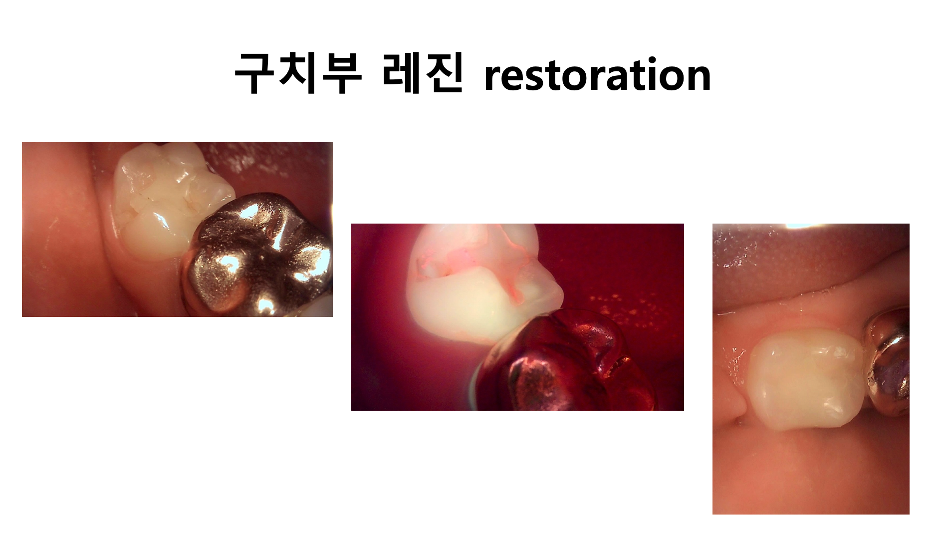 뉴욕S치과의원 광화문 대표 이미지