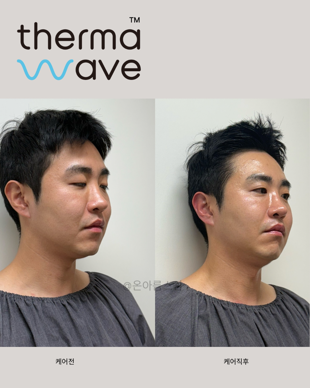 온아름스킨 대표 이미지