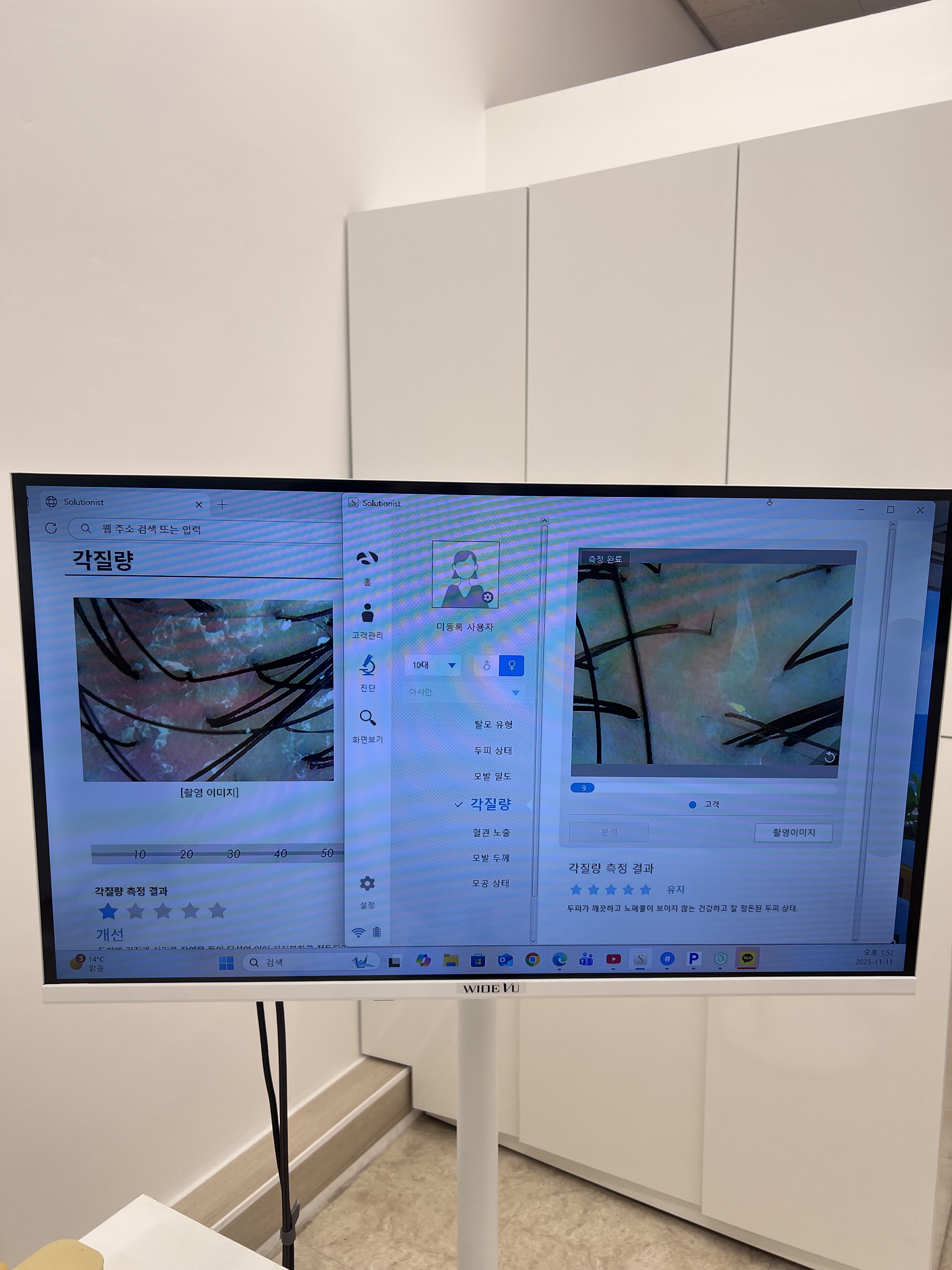 라니두피관리 대표 이미지