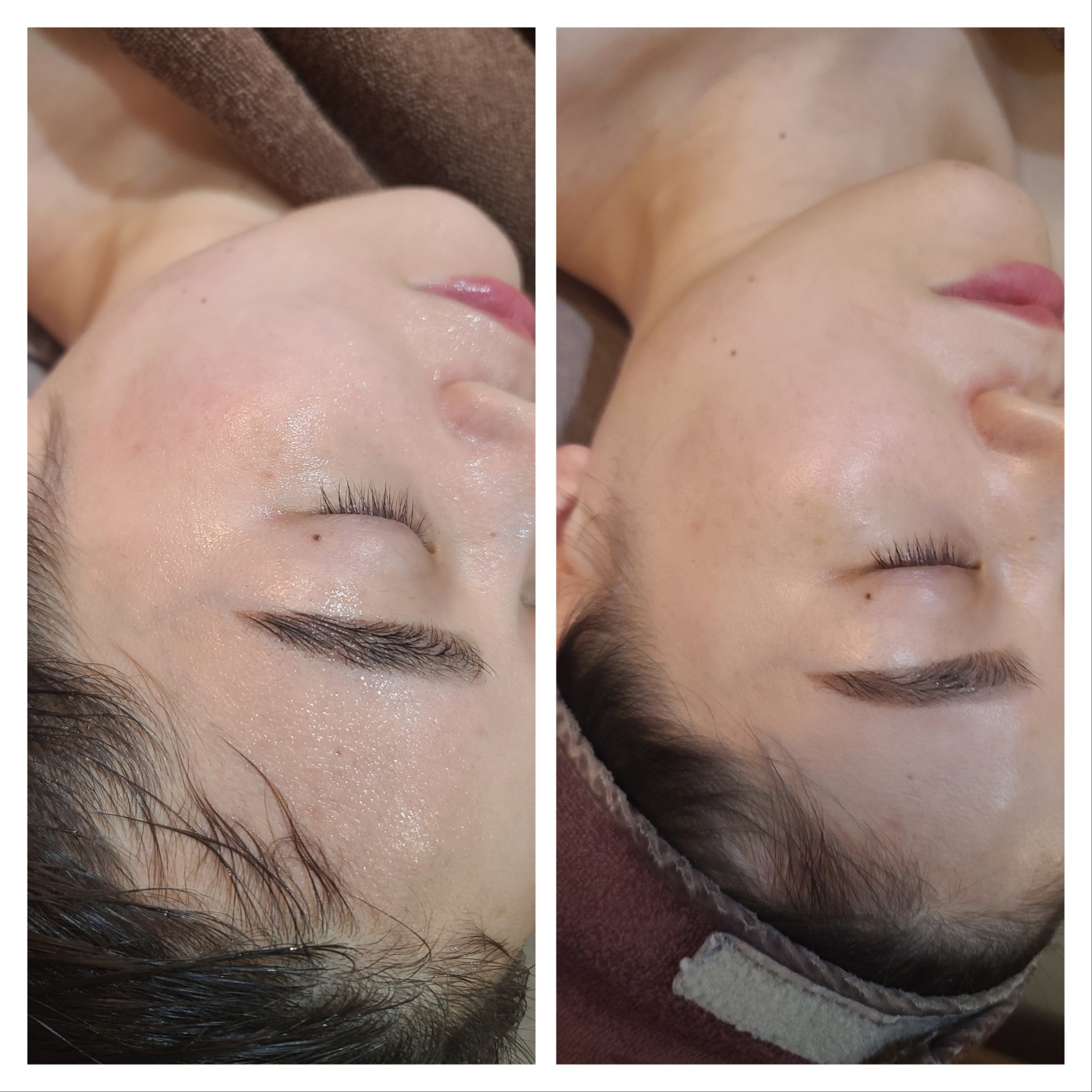 본미에스테틱 대표 이미지