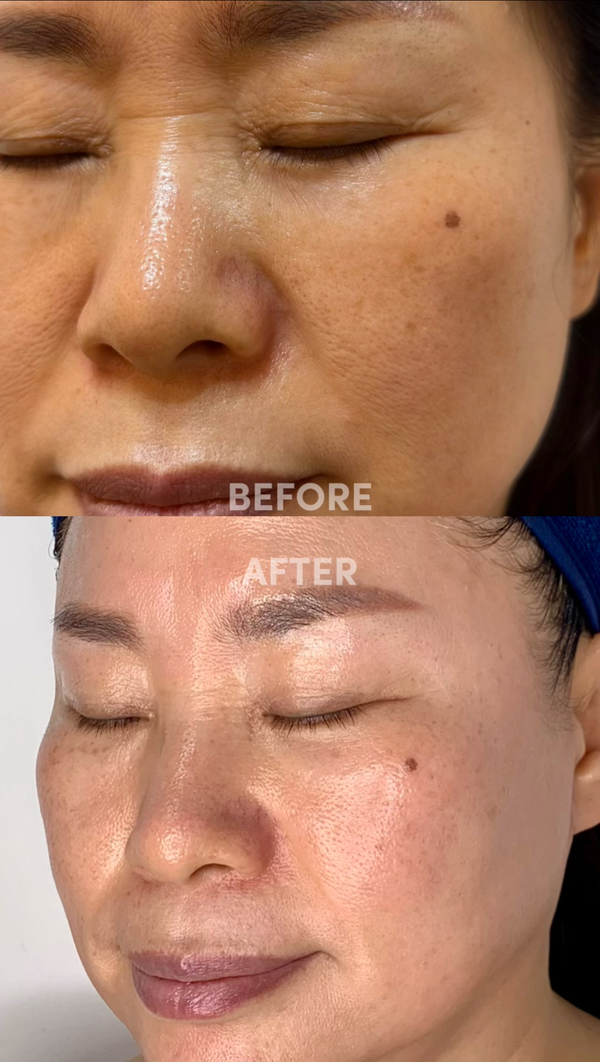 원스 에스테틱 포항점 대표 이미지