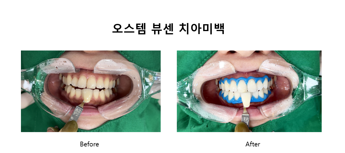 뉴욕S치과의원 광화문 대표 이미지
