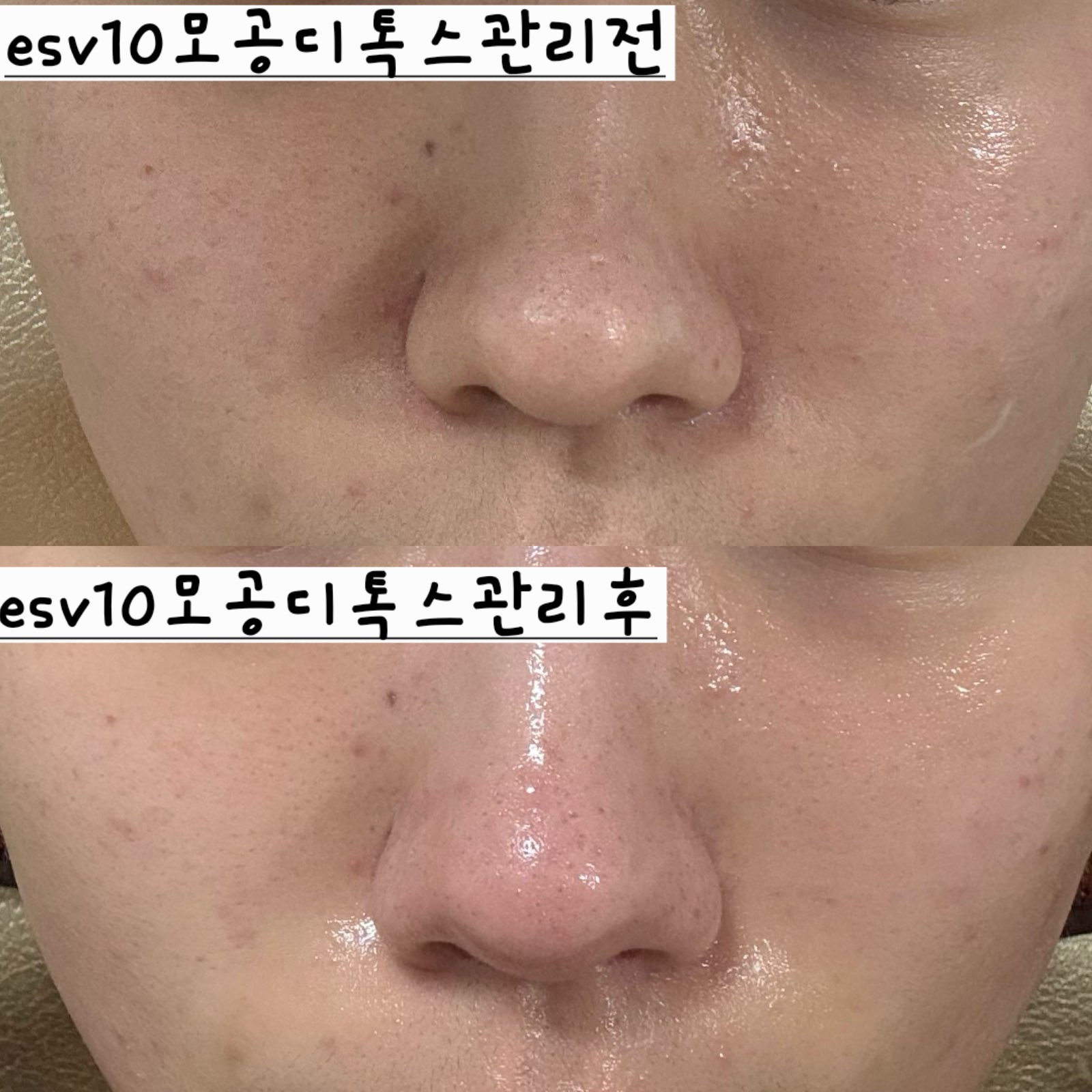 본스킨앤바디 대표 이미지