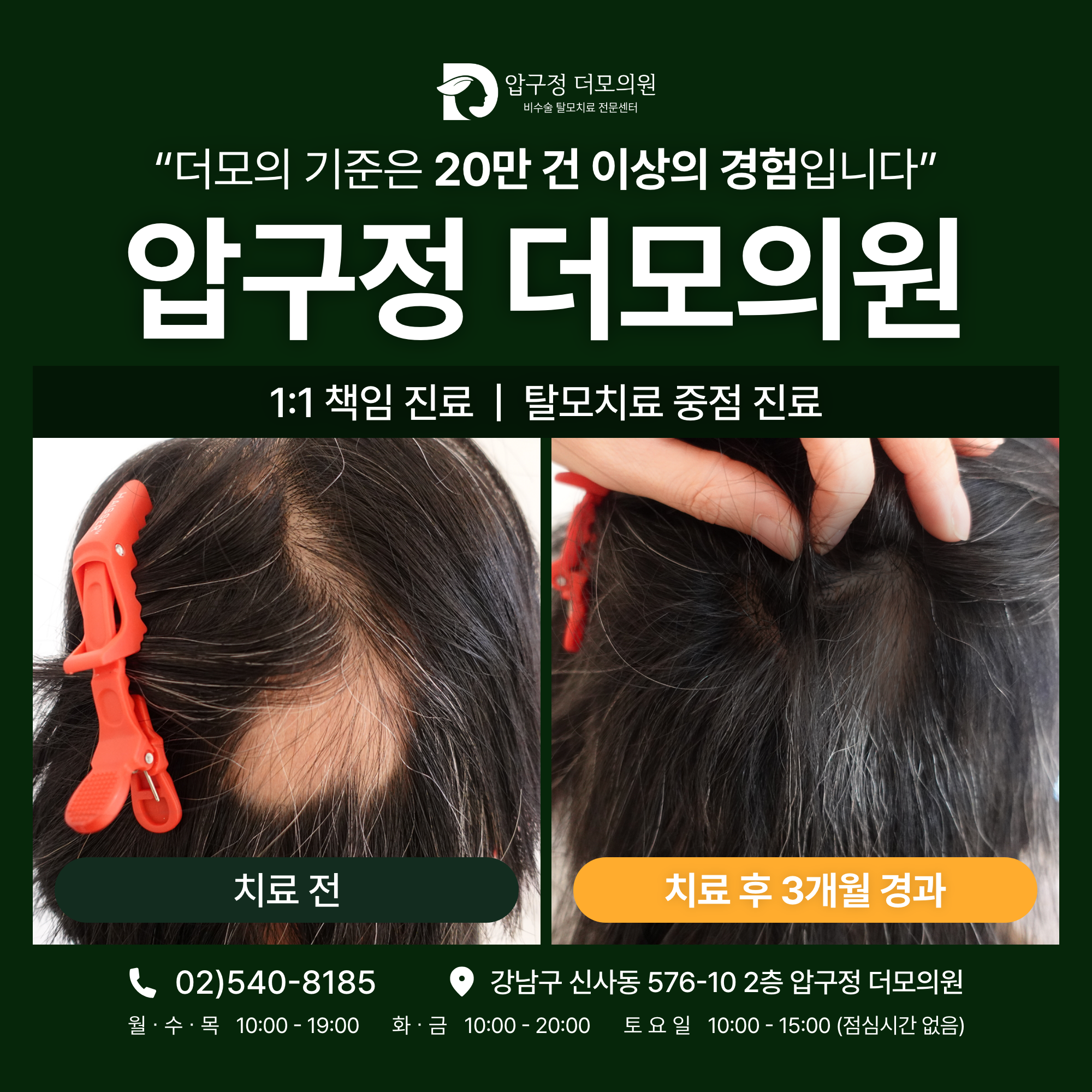 압구정더모의원 대표 이미지