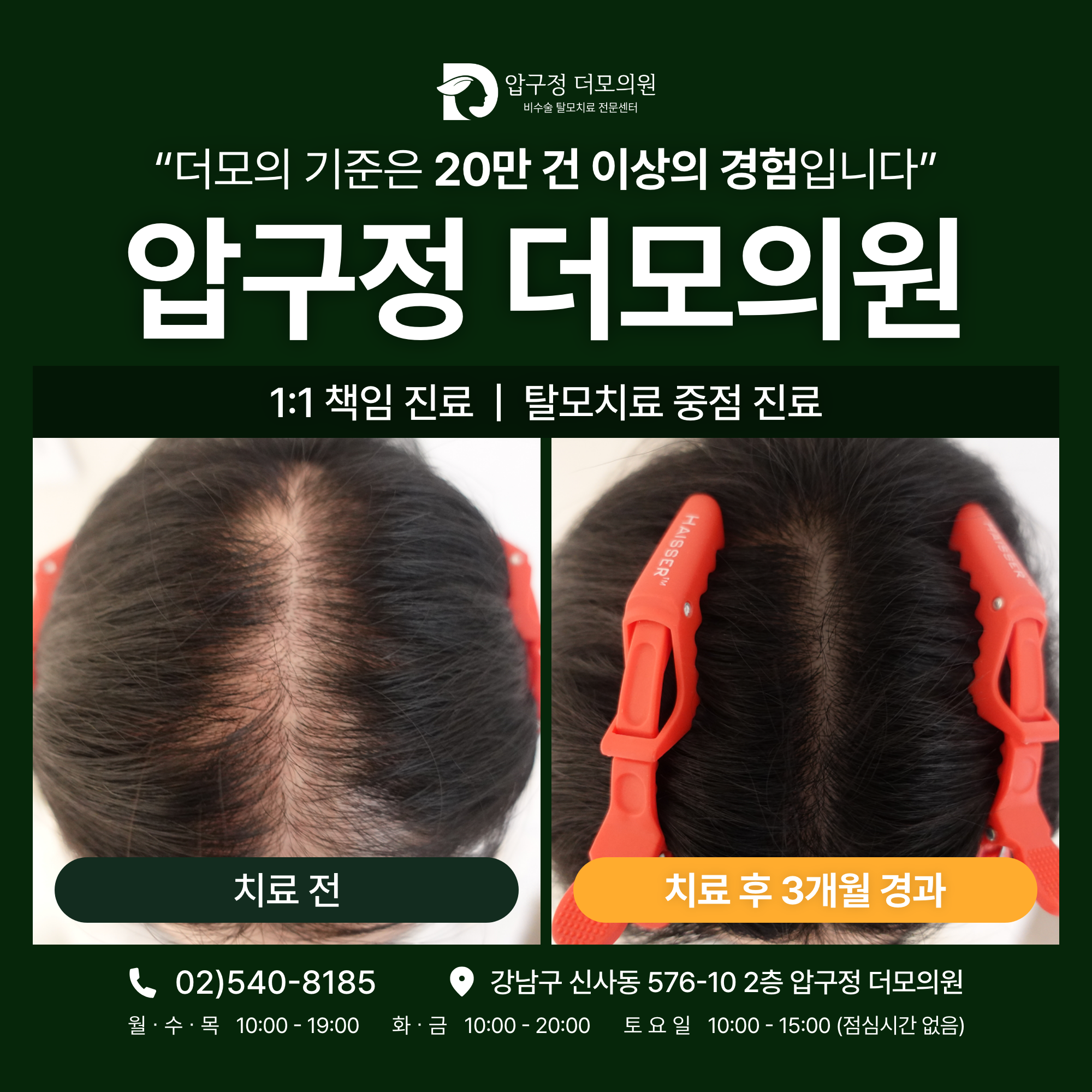 압구정더모의원 대표 이미지