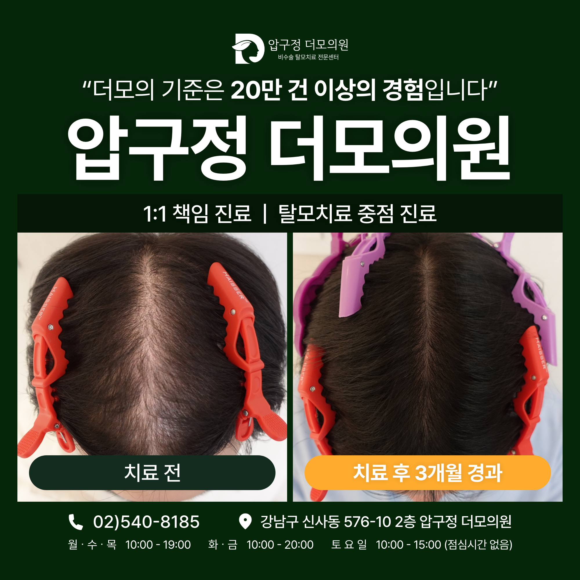 압구정더모의원 대표 이미지