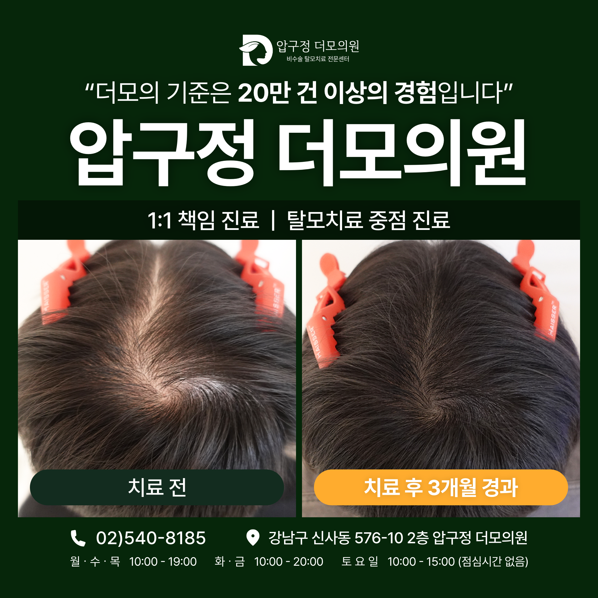 압구정더모의원 대표 이미지