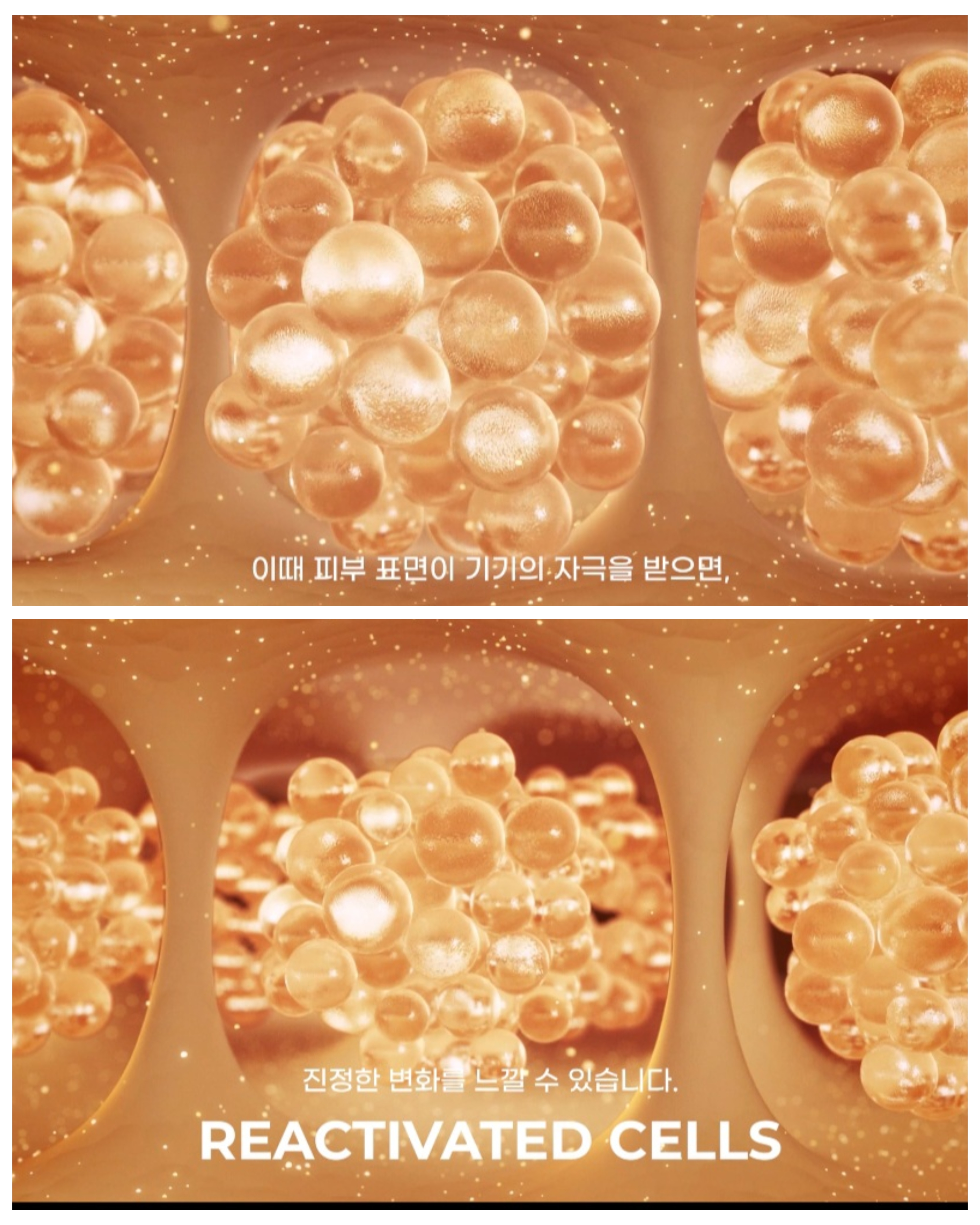 인치바이인치_LPG 엔더몰로지 인천부평점 photo 7