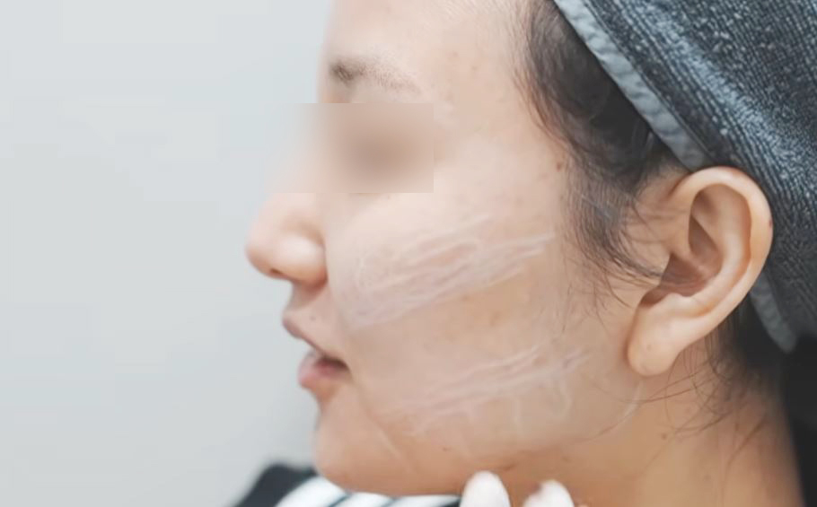 여름의원 강남 대표 이미지