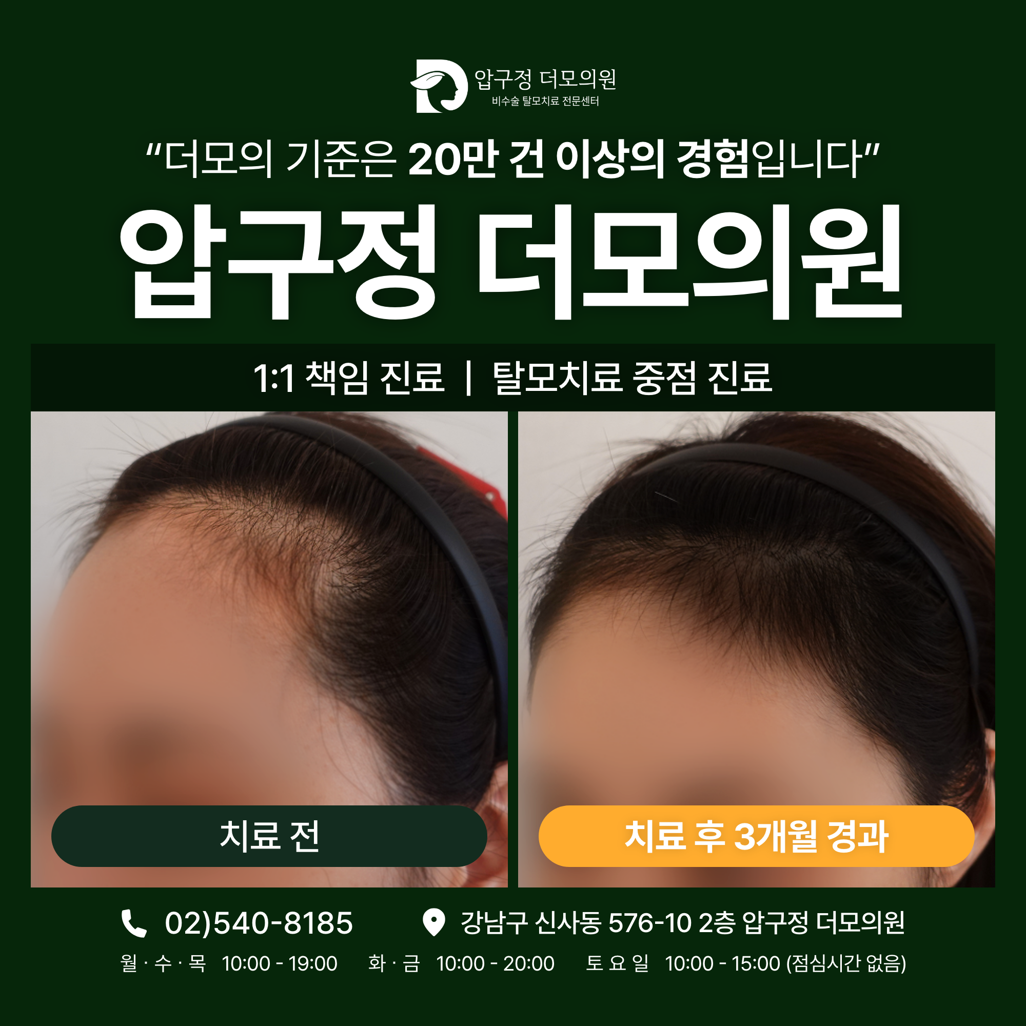 압구정더모의원 대표 이미지