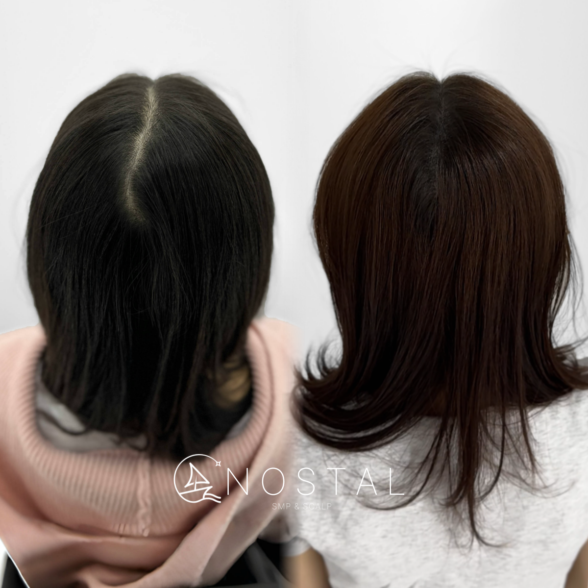 노스탈 대표 이미지