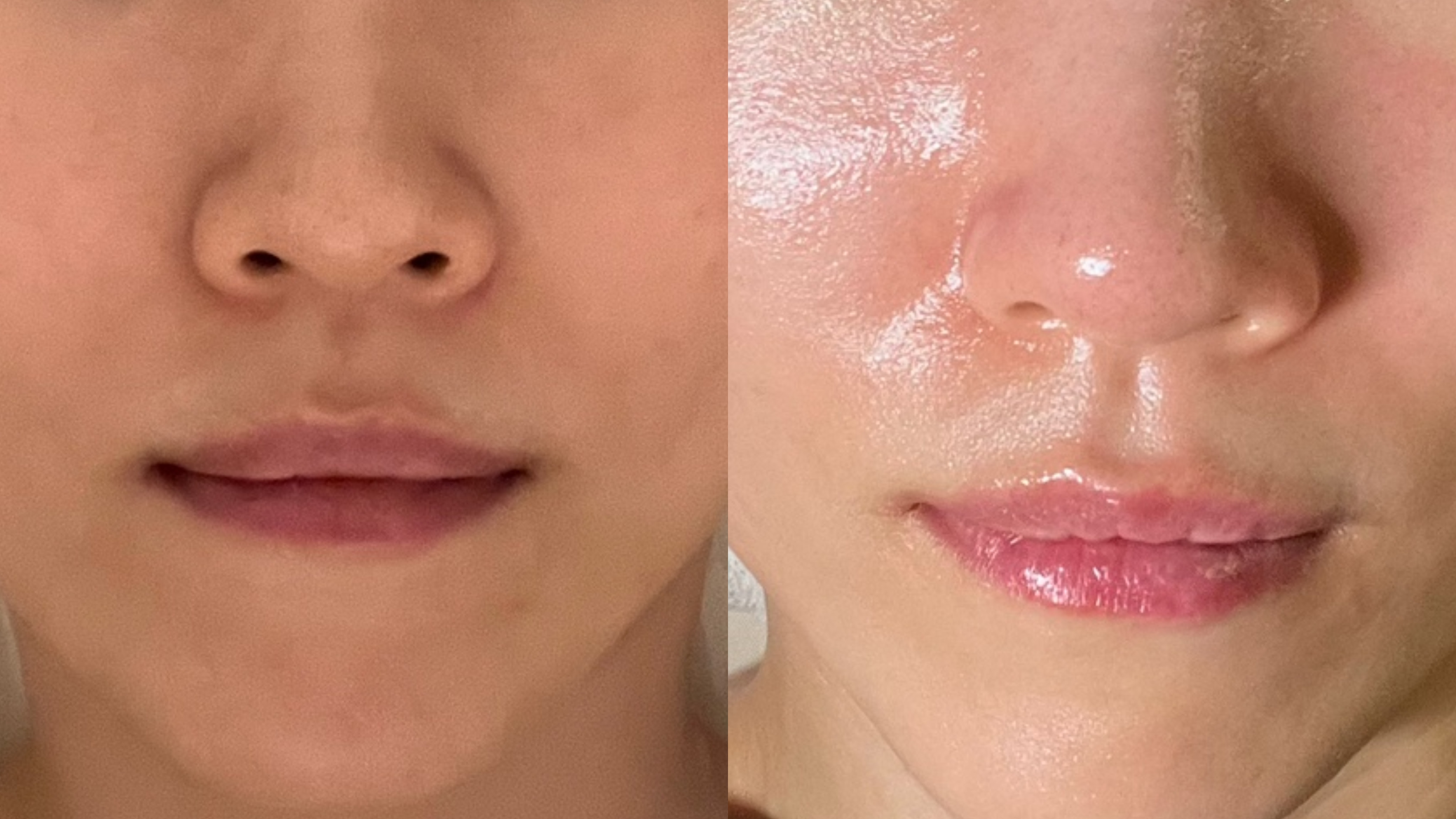 피부하라 photo 2