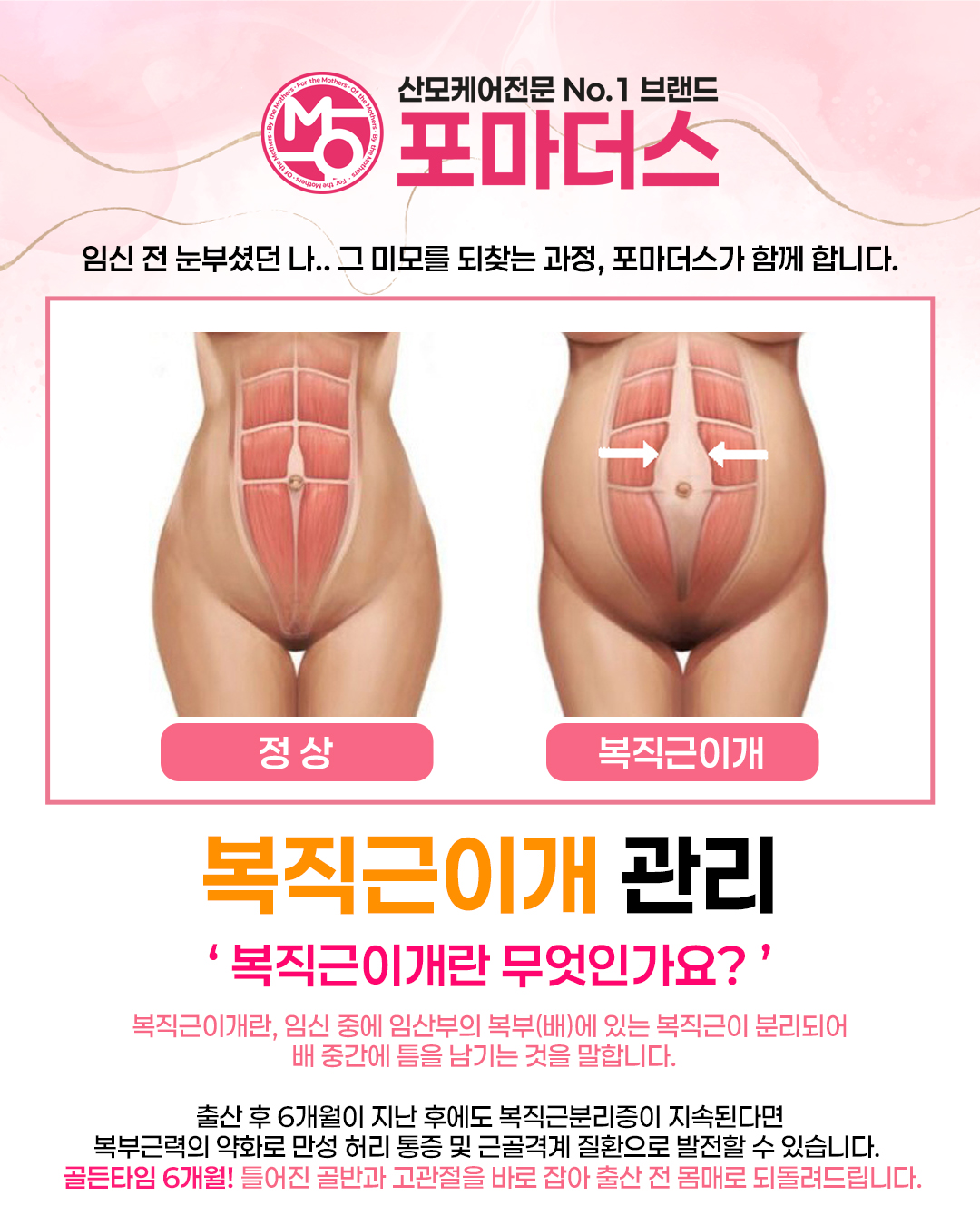포마더스 photo 7