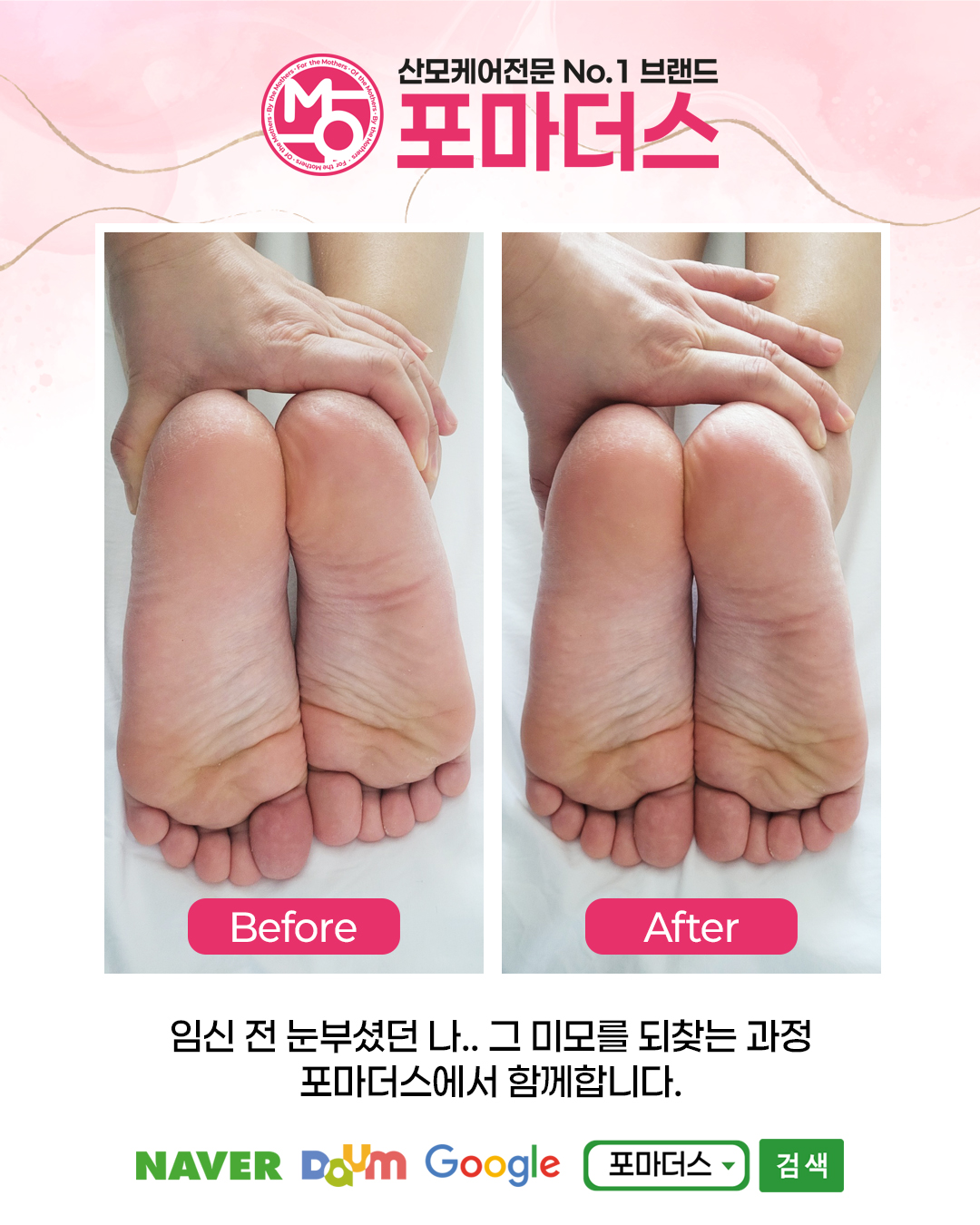 포마더스 photo 6