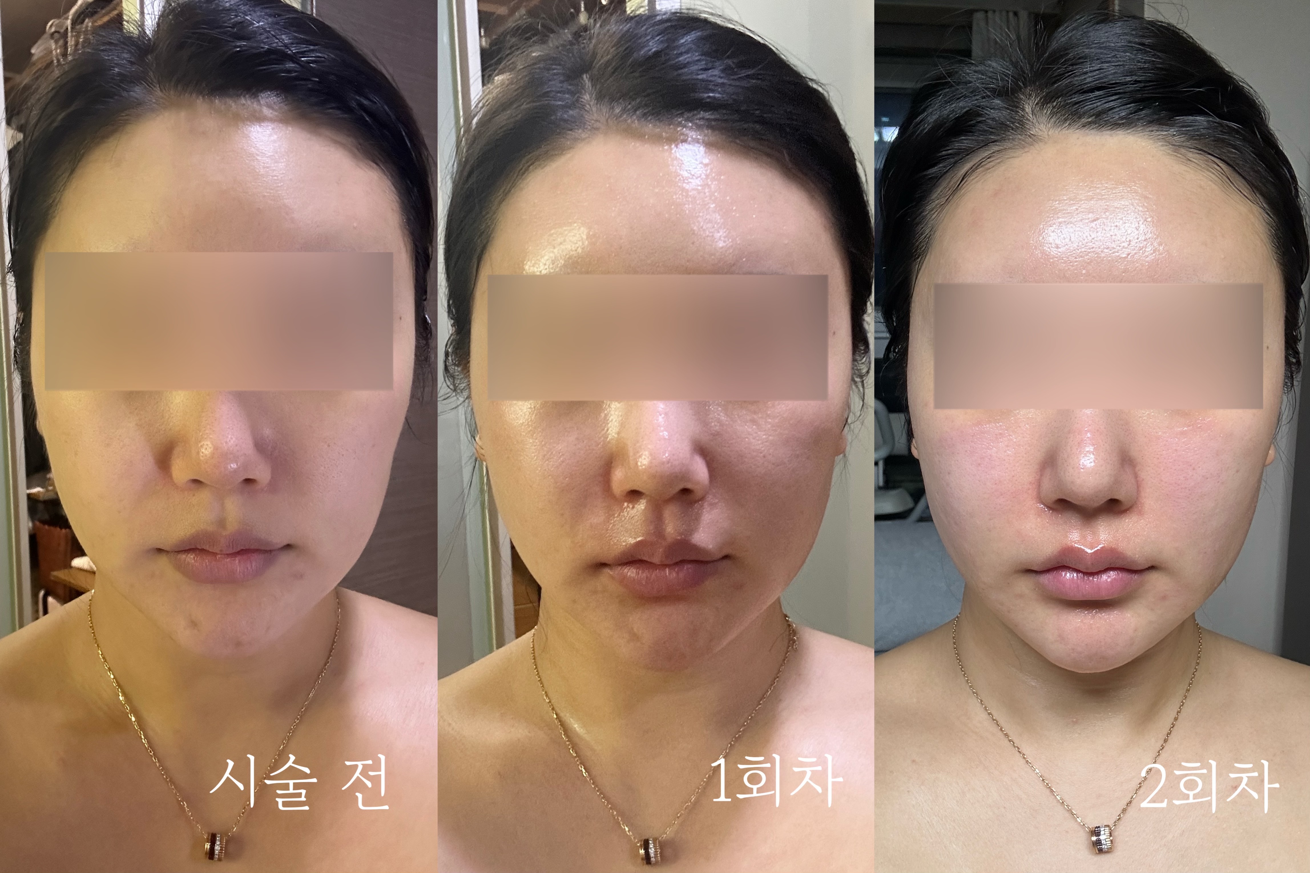 블레싱스킨케어 대표 이미지