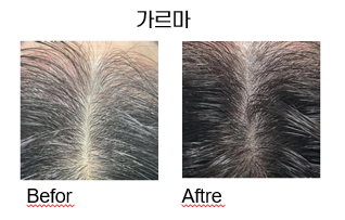 서래뷰티 대표 이미지