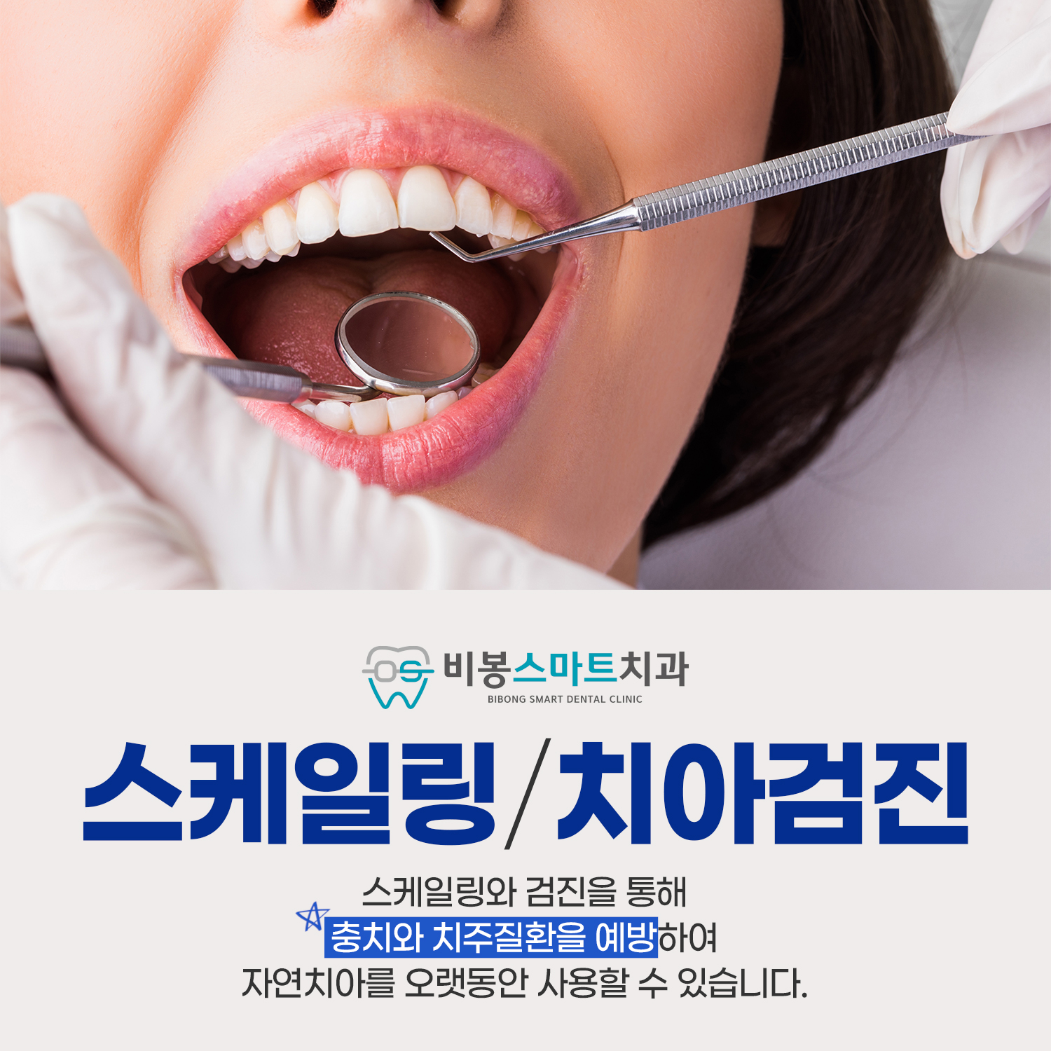 비봉스마트치과의원 대표 이미지