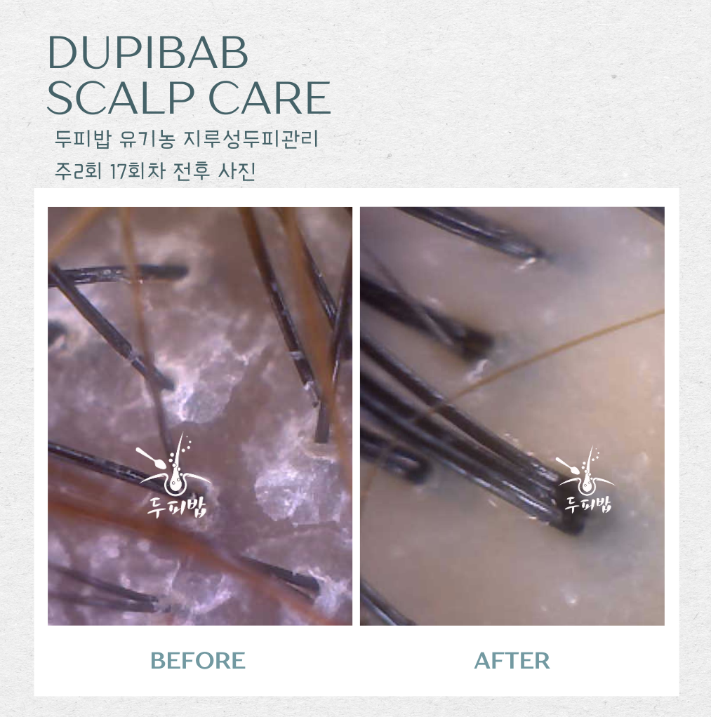 두피밥 대표 이미지