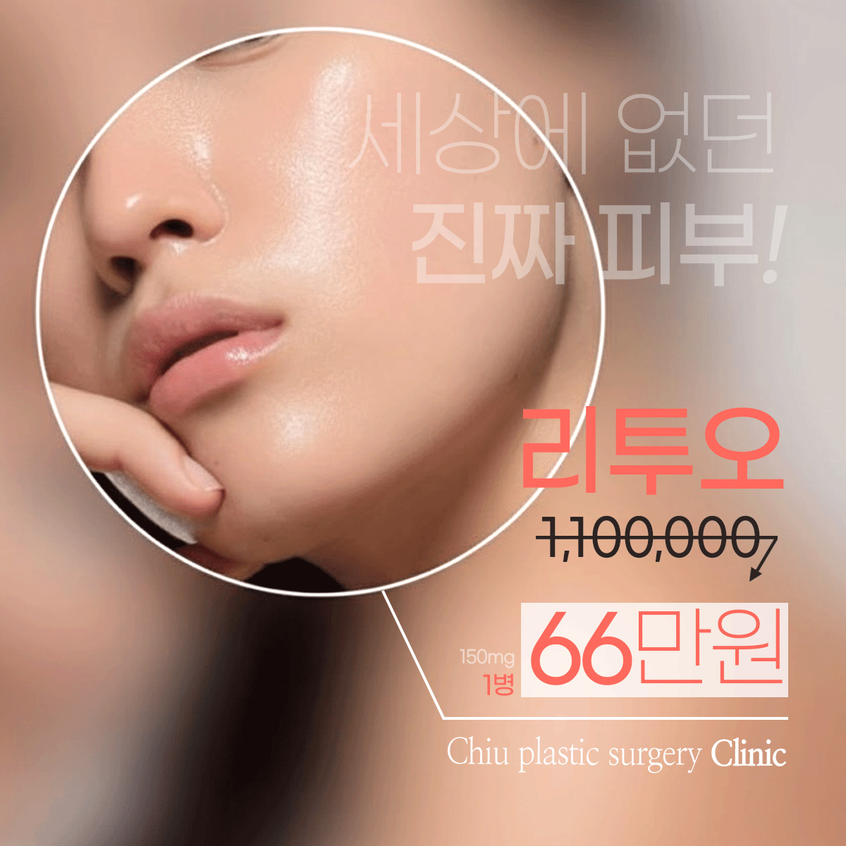 치유성형외과 대표 이미지