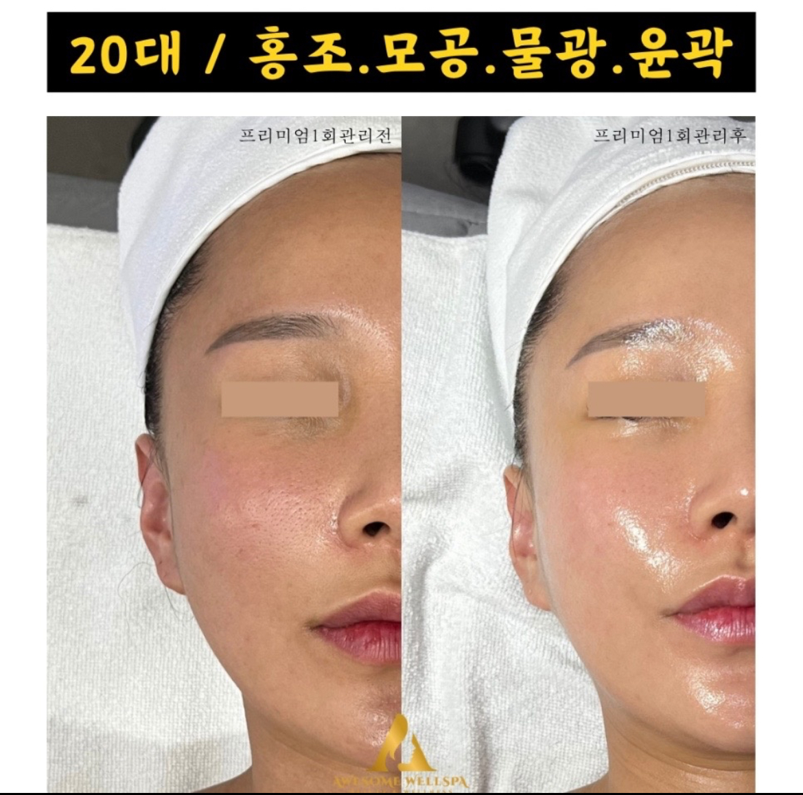 봉담에스테틱어썸 대표 이미지