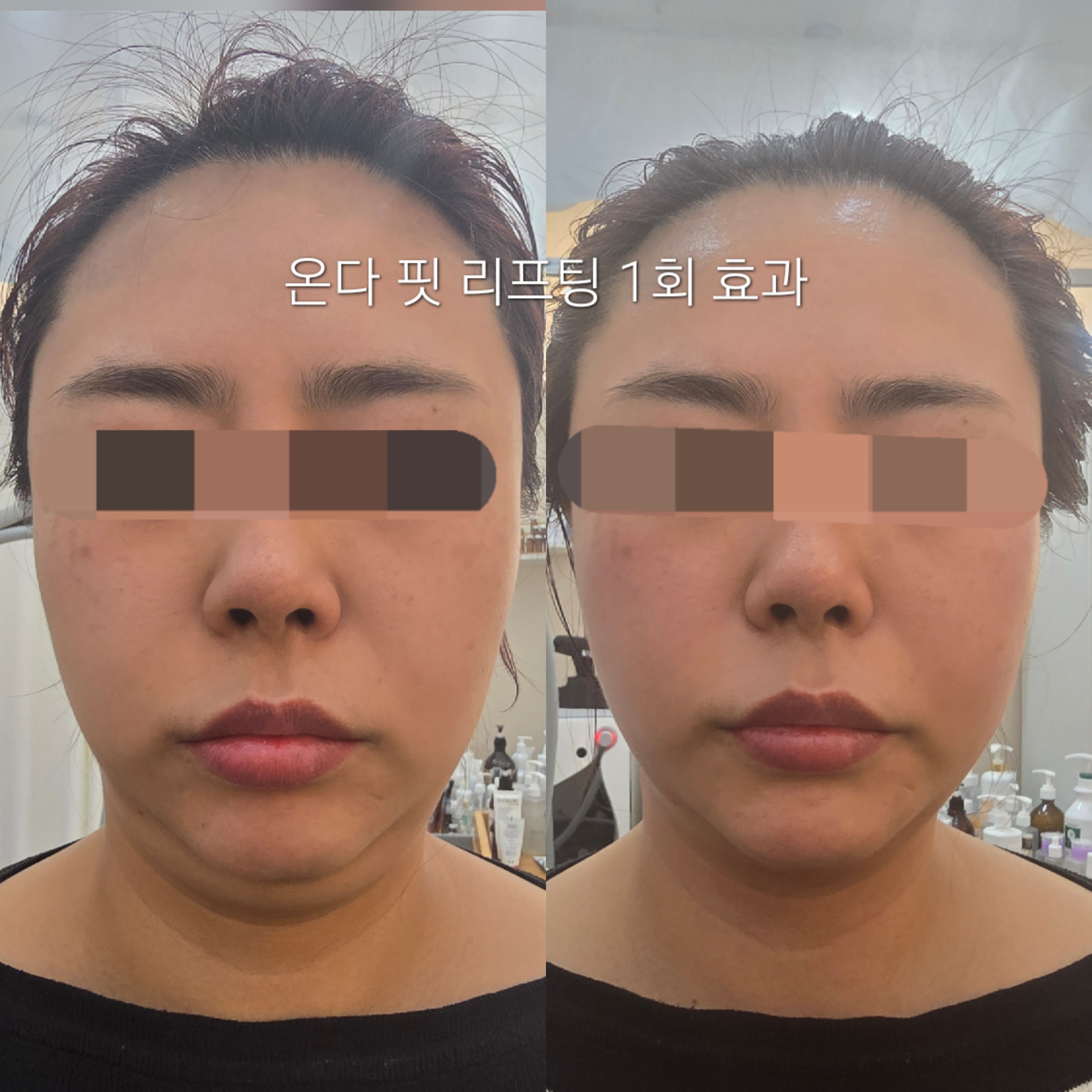 블레싱스킨케어 대표 이미지