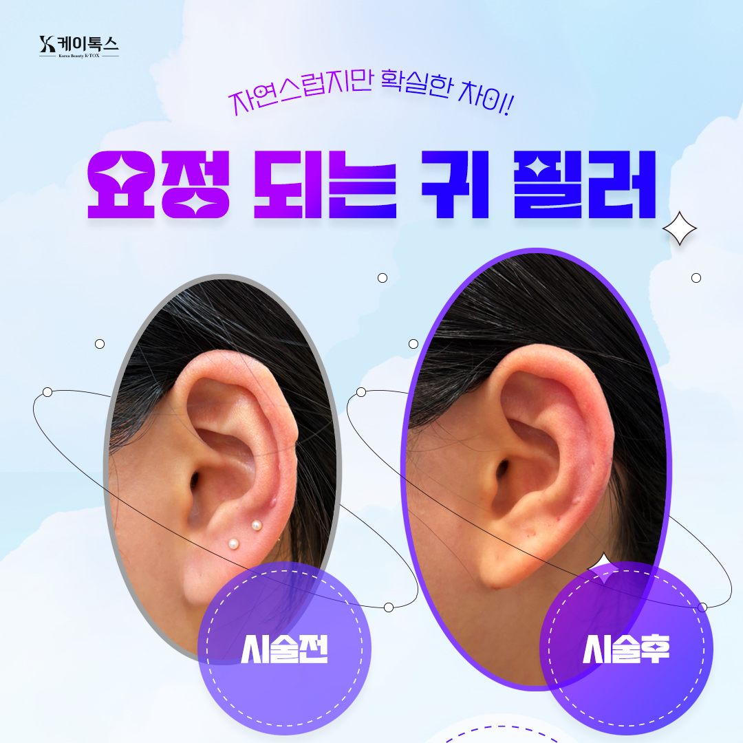 케이톡스의원 인천구월 대표 이미지