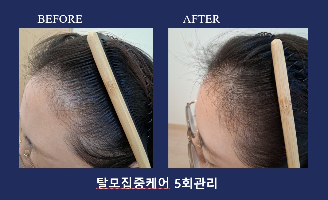 하루두피 동탄1점 대표 이미지