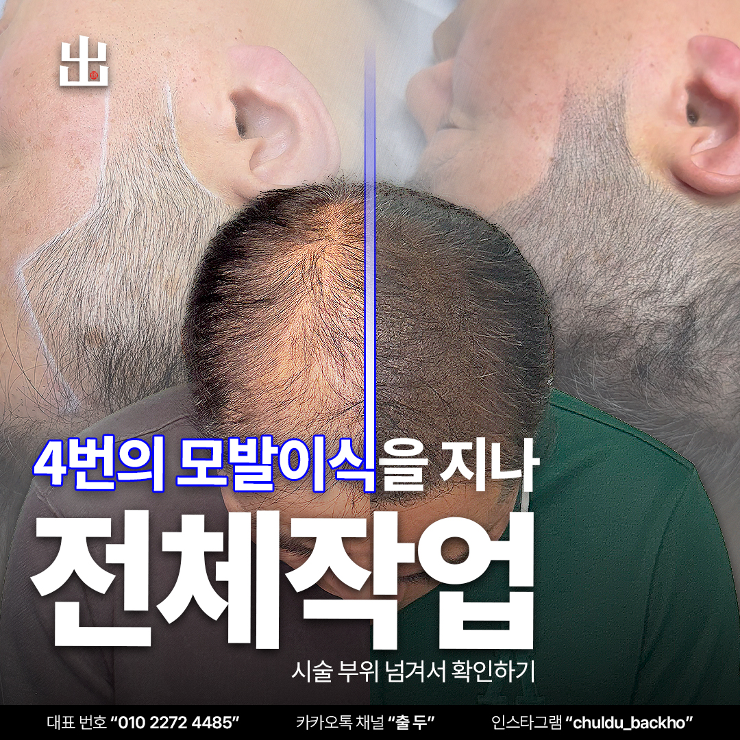 출두SMP 강남본점 대표 이미지
