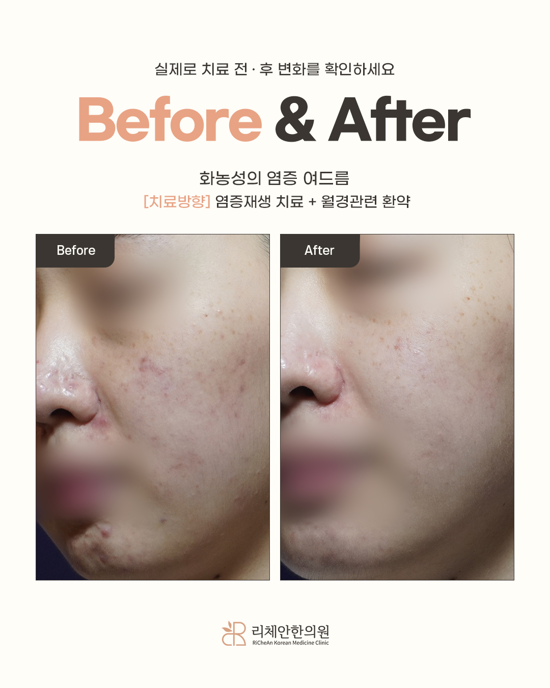 리체안한의원 당산 대표 이미지