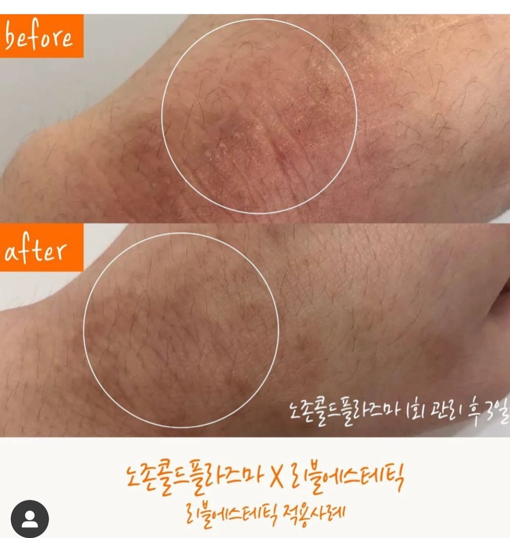 미고스킨바디 대표 이미지