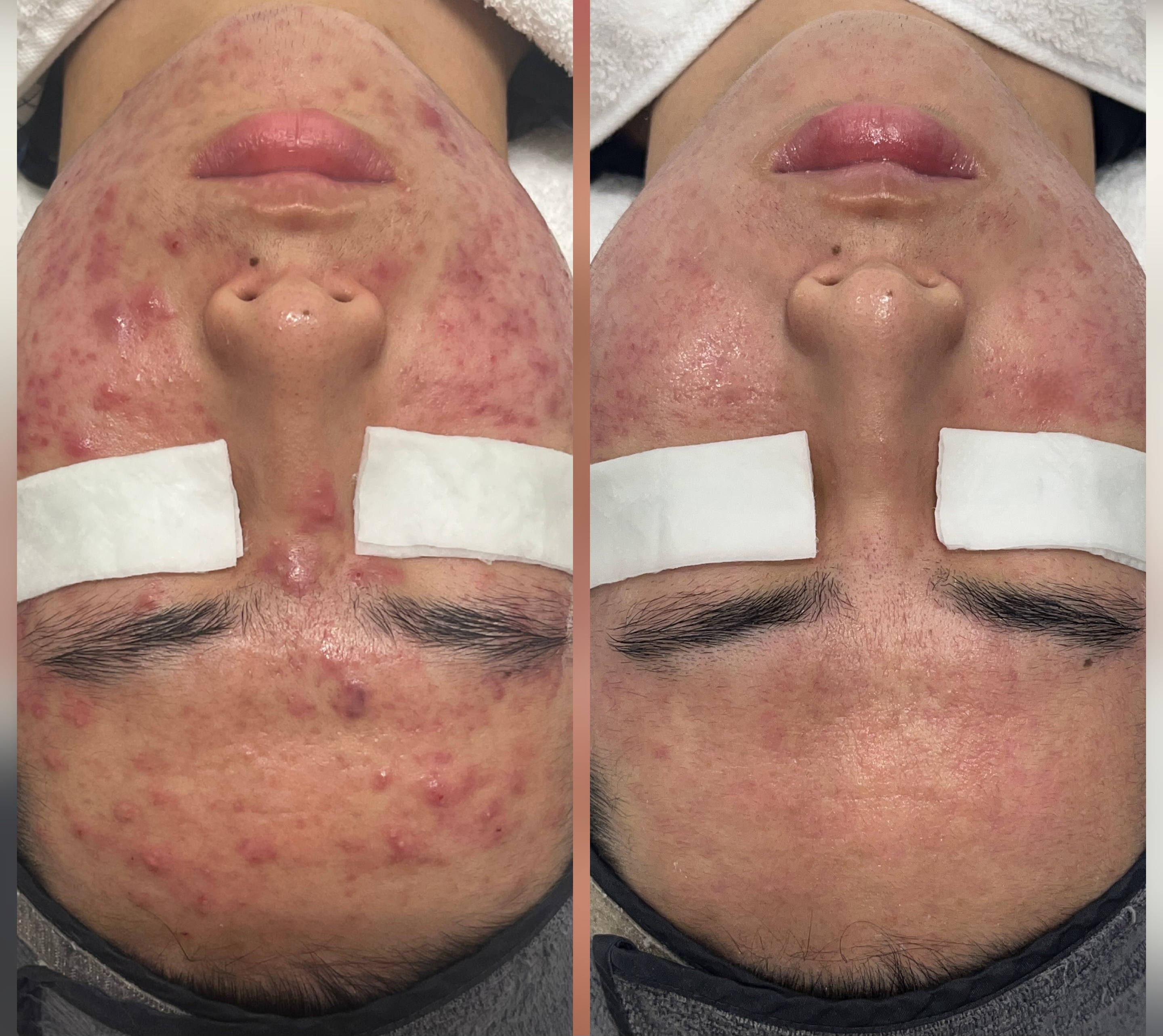 연에스테틱 대표 이미지