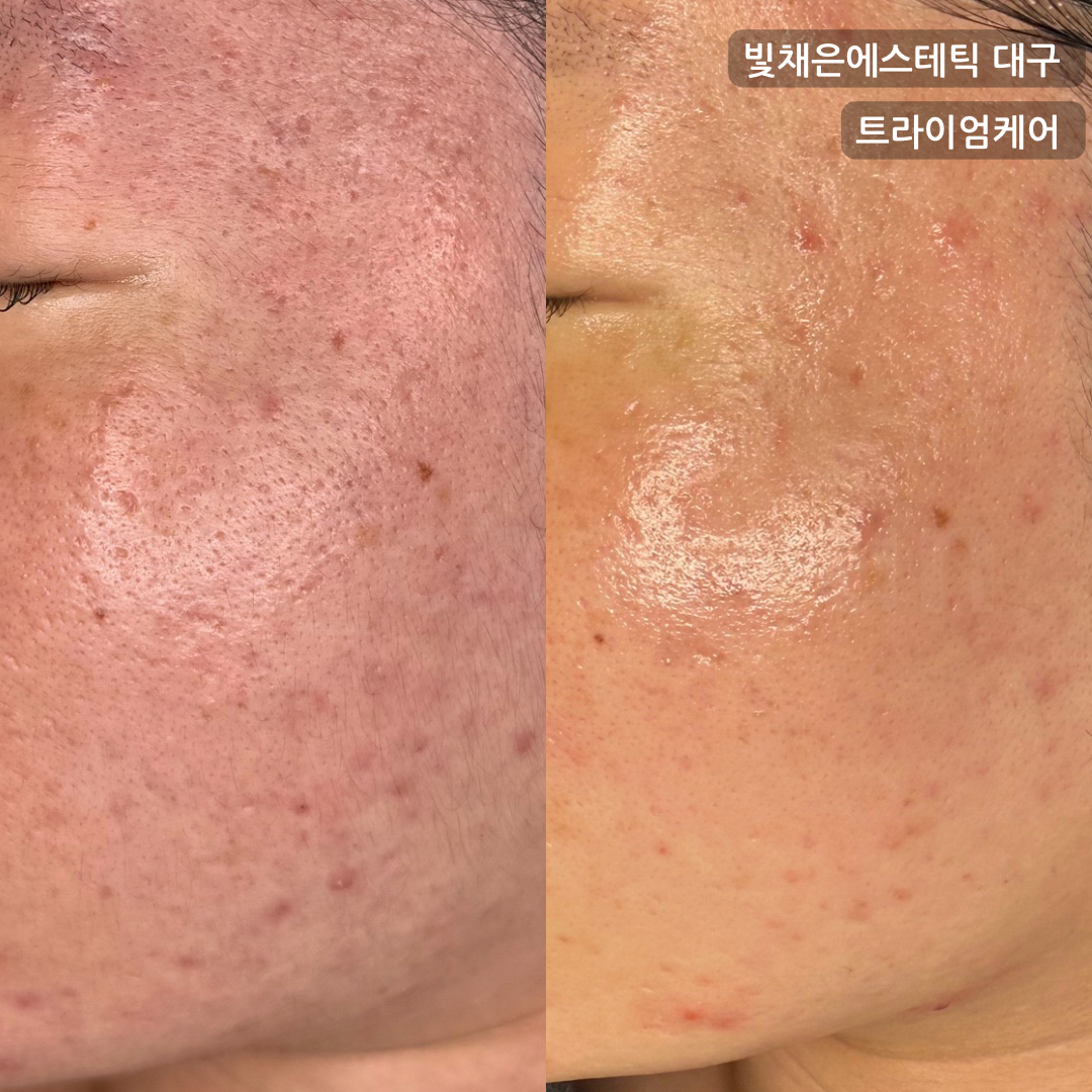 빛채은에스테틱 대표 이미지