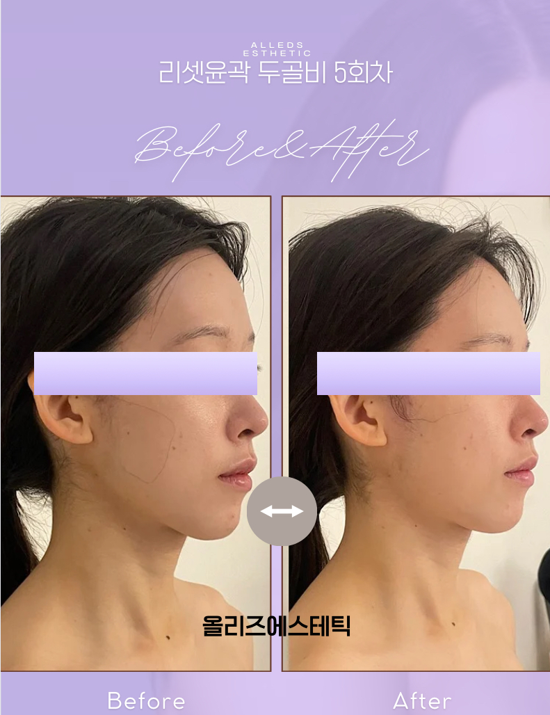 올리즈에스테틱 대표 이미지