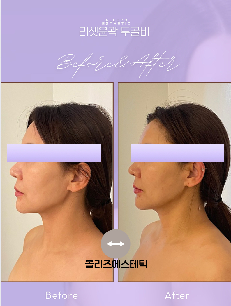올리즈에스테틱 대표 이미지