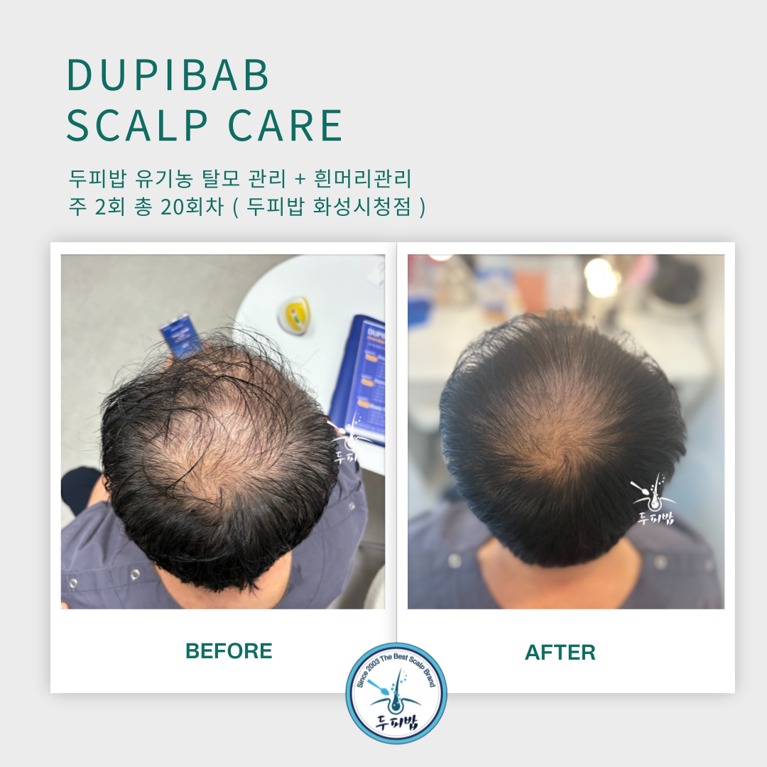 두피밥 대표 이미지