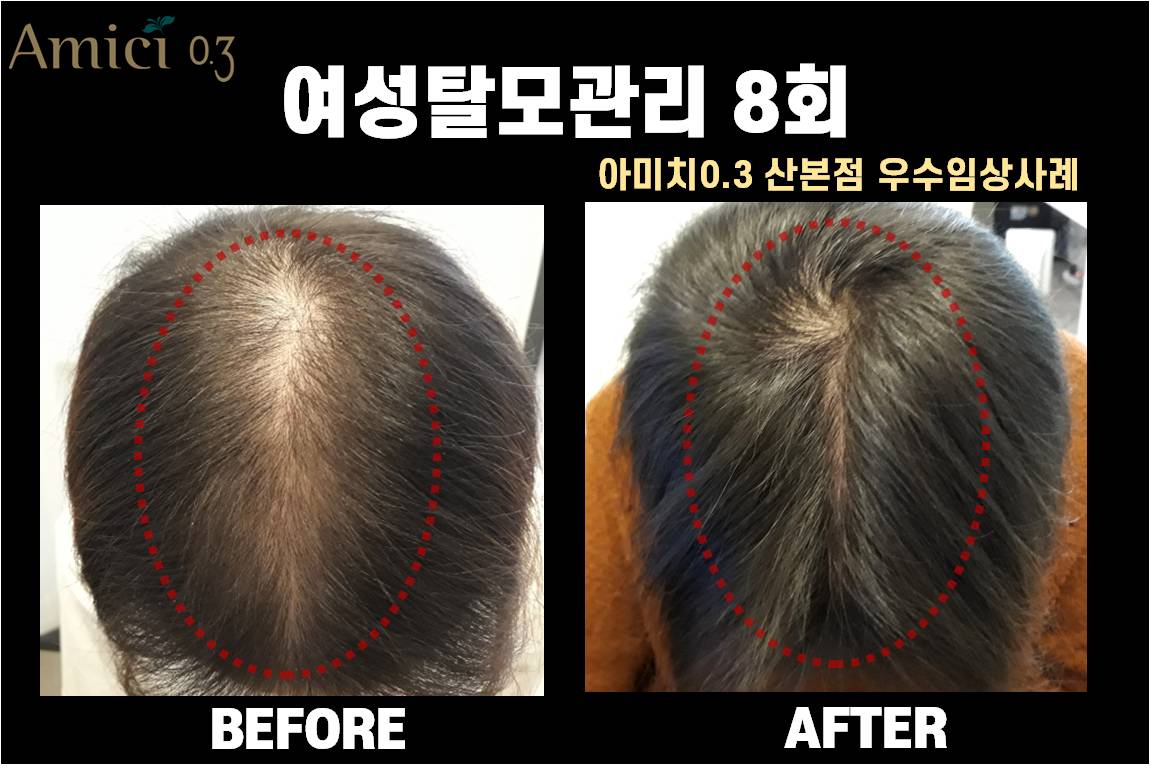 아미치0.3 산본점 대표 이미지