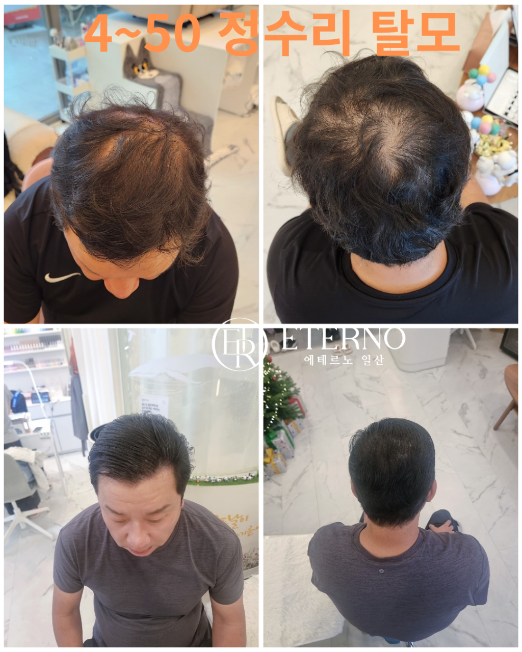 에테르노 대표 이미지